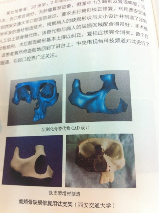 中国数字科技馆(图30) 3d打印fdm技术_3D打印应用领域_3D打印技术原理