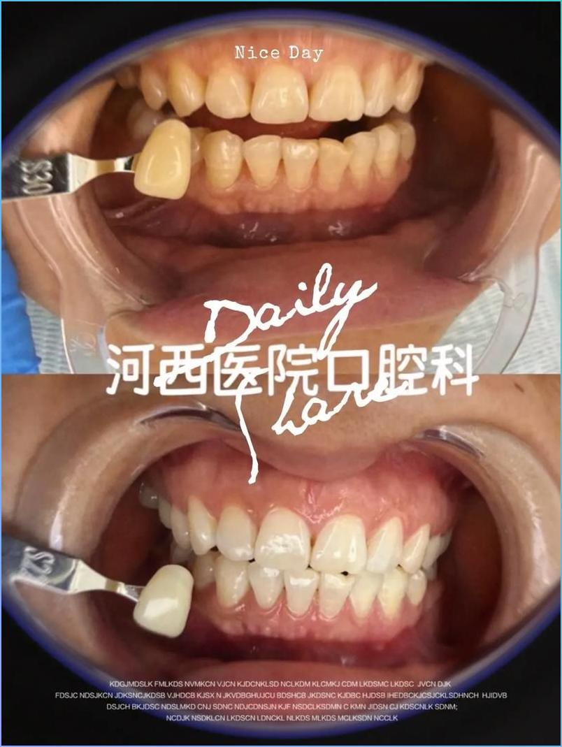 小红书爆火PS修图术首次公开!6招让照片美到犯规(图4) photoshop数码照片处理高手之道_智能磨皮不伤纹理_PS高级修图技巧