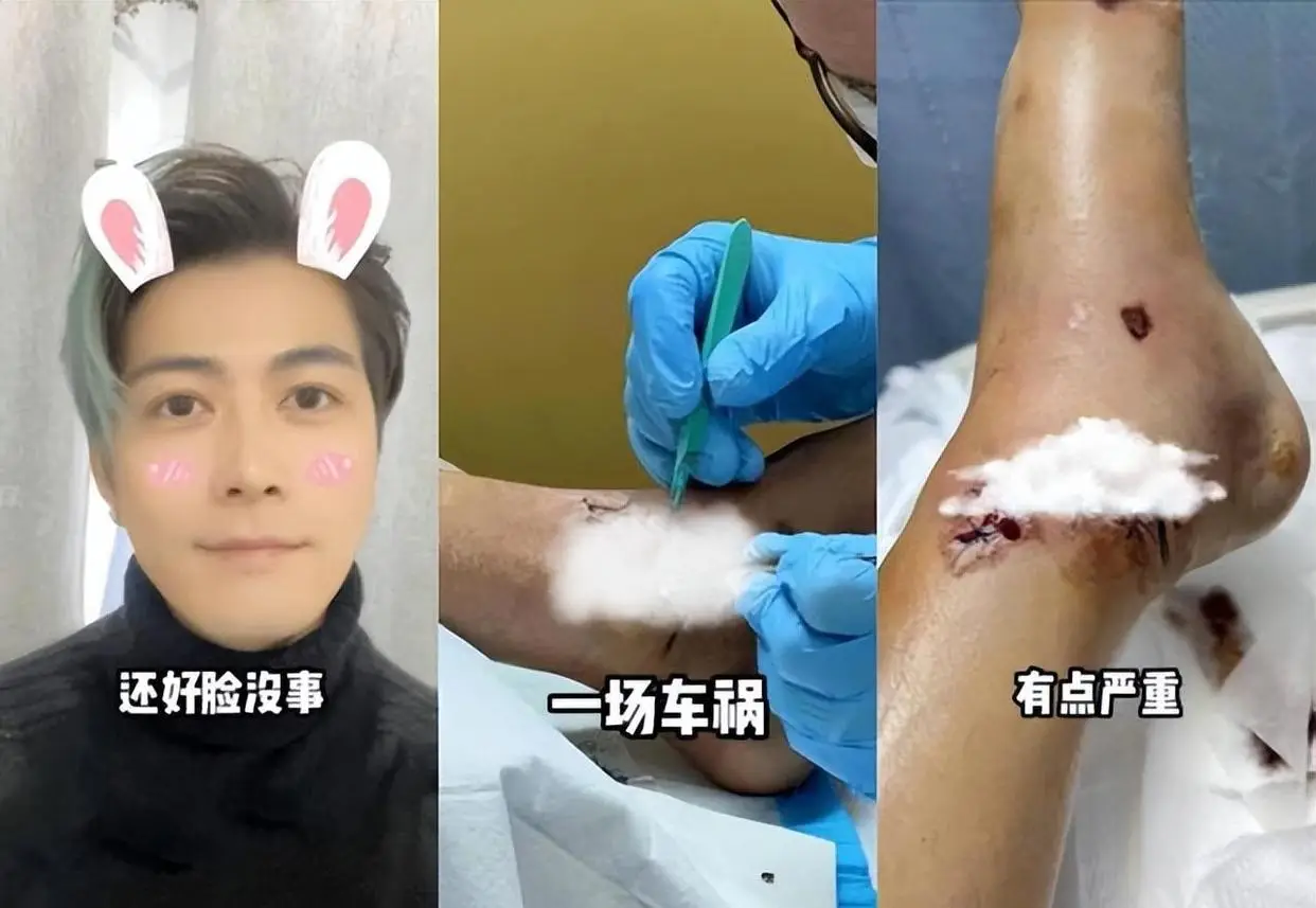 演员陈学冬:近几年频繁手术,现生活无法自理(图8) 陈学冬病床照片_陈学冬车祸真相_和力辰光传媒陈学冬