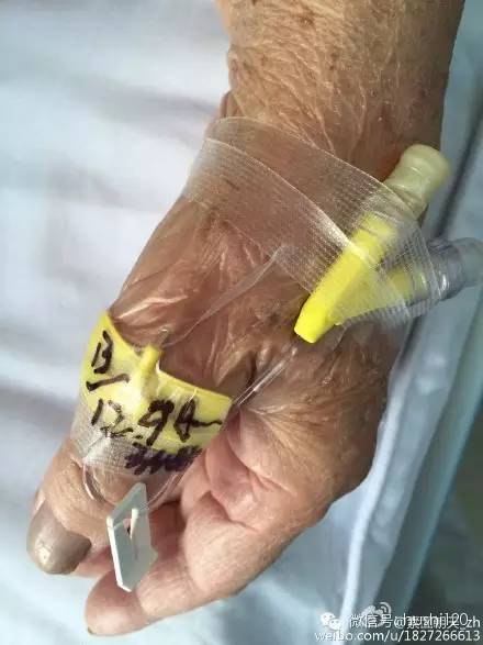 能穿刺的静脉都没成功，这些位置的静脉你可以试试