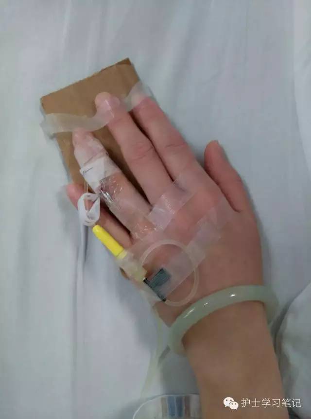 能穿刺的静脉都没成功,这些位置的静脉你可以试试(图19) 静脉穿刺奇葩部位_护士静脉穿刺技巧_静脉输液扎针技巧