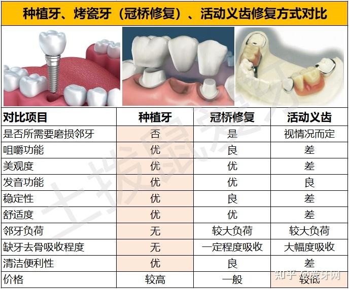 种植牙和装假牙，两种方式的优劣是什么？