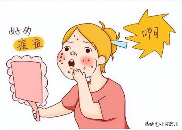 活久见，治好我脸上痘痘的竟然是避孕药！！！