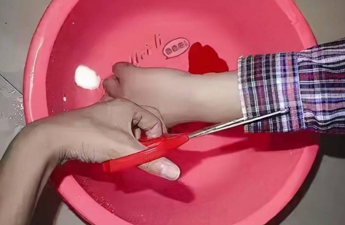 孩子油烫伤处理方法_火烫伤起泡怎么处理_油炸年货做法